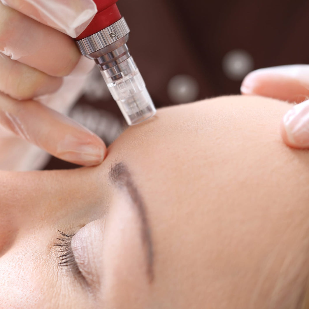 Kaz’s Beauty- microneedling  Add-on £50 per treatment for hands, neck or cleavage