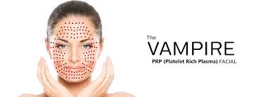 Kaz’s Beauty- PRP (Protein Rich Plasma) Vampire Facial  course of 3